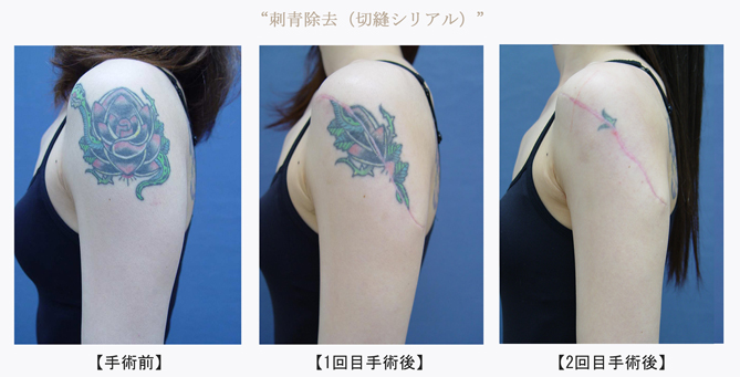 刺青切縫シリアル669.jpg