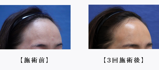 レニスナ669.jpg